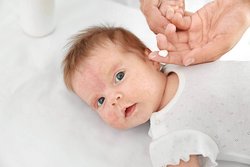 Neurodermitis beim Baby - Symptome, Ursachen & Behandlung