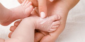 Trockene Babyhaut – Ursachen und die richtige Pflege