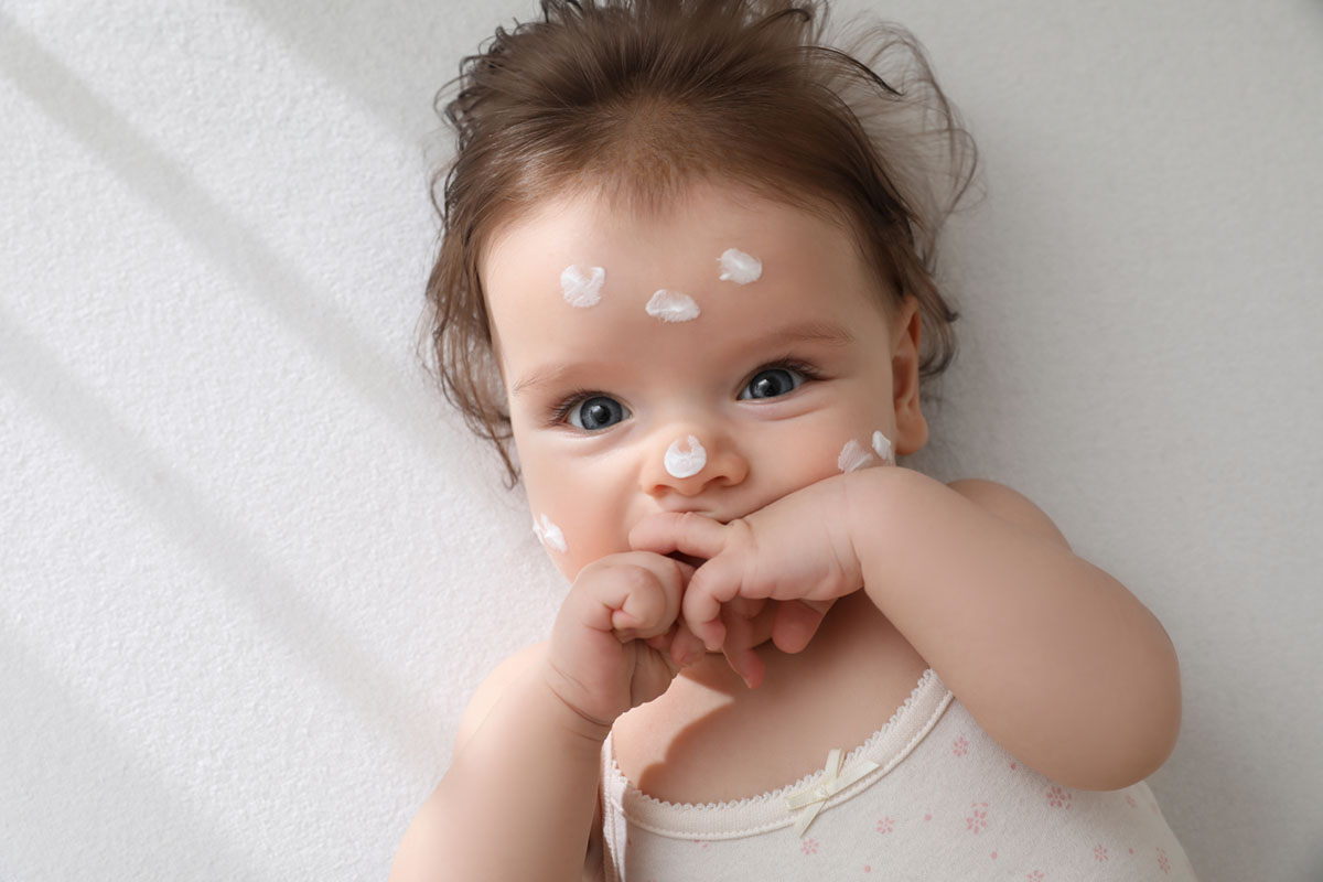 Lying baby with a few dabs of cream on its face, symbolising the suitable cream for dry skin in babies