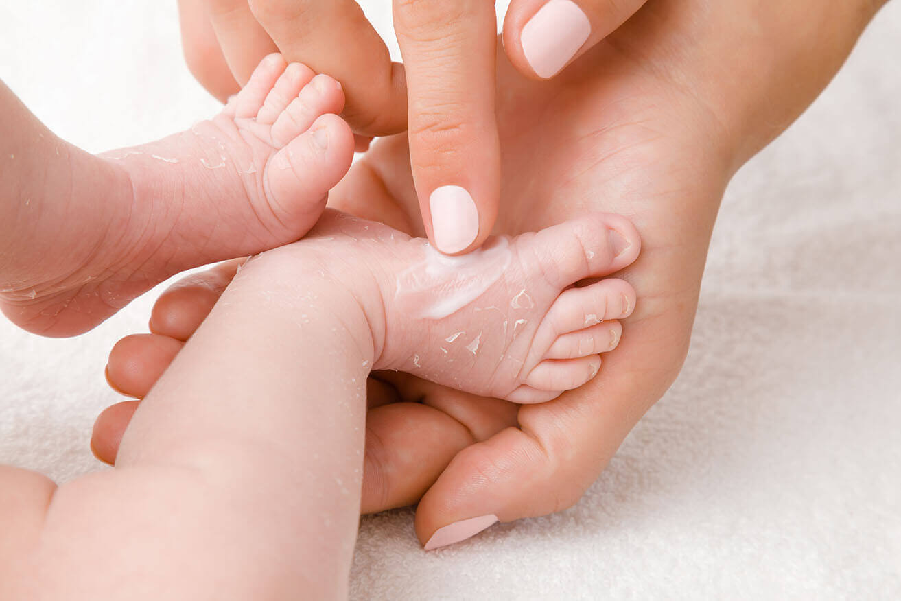 [Translate to en_DE:] Trockene Babyhaut – Ursachen und die richtige Pflege